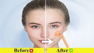 TUMAKOU High Frequency Facial Machine Review  Glowing Skin at Home!