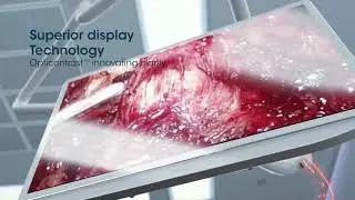 Advanced Digital O.R. with Sony