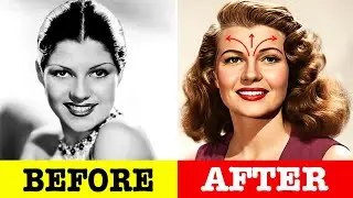 21 TOP Secret Surgeries That Transformed Golden Age Stars Forever: #7 Is SHOCKING!