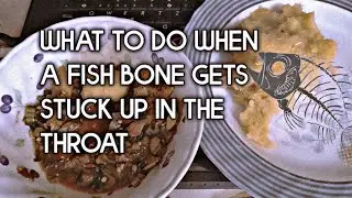 WHAT TO DO WHEN A FISH BONE GETS STUCK UP IN THE THROAT | LIVE EXPERIENCE 