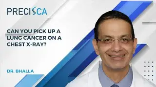 Can you pick up a lung cancer on a chest x-ray?