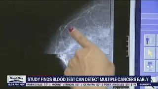 Study finds blood test can detect multiple cancers early | FOX 13 Seattle