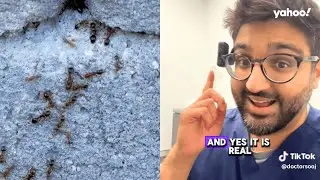 Ants have a smell - here&rsquo;s why only some people can smell it | Yahoo Australia