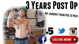 Top Surgery 3 years Post Op2