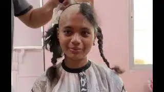 Full Story of bald Beauty| #VivanteShivani