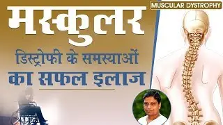 Muscular Dystrophy (मस्कुलर डिस्ट्रोफी) के समस्याओं का सफल इलाज | Acharya Balkrishna