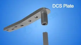 DCS Plate From AUXEIN MEDICAL
