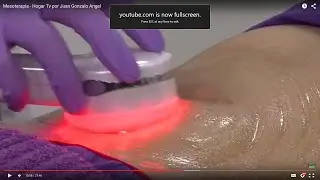 Como hacer Mesoterapia Virtual - Hogar Tv  por Juan Gonzalo Angel
