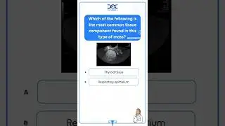 Adnexal Mass on Ultrasound: Understanding the Basics for PG Residents