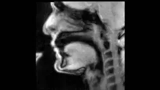 Douglas Yeo, trombone - MRI video 2 - intervals
