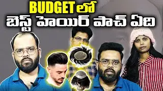 Low Cost & Best Hair Patch In Non Surgical Hair Replacement || Best Hair Patch For Men