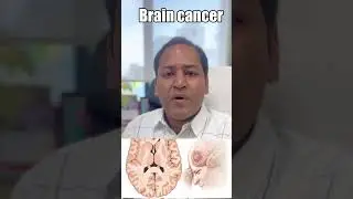 Cancer Vaccine Breakthrough! Promising Results from mRNA Trials