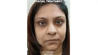 Want Glass-like glow on your Face? Try our Korean Glass Skin treatment