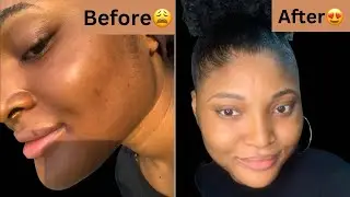 The BEST Lightening Face Cream!✨