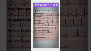 how read to E.C.G#ecg#diagram#youtube#shorts#viral