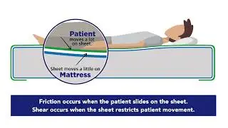 Debunking The Myth That A Hospital Mattress Cover Affects Skin Shear and Friction.