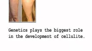 Jergens Cellulite Lotion