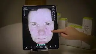 Observ huidscan