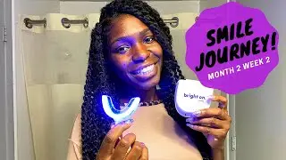 Smile Direct Club| Smile Journey M2 W2