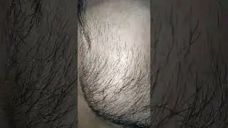 Best beard result from MARS BY GHC MINOXIDIL #wantbeard #shorts