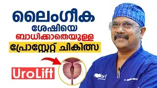 ലൈംഗീക ശേഷിയെ ബാധിക്കാതെയുള്ള പ്രോസ്റ്റേറ്റ് ചികിത്സ  UroLift Malayalam  Dr Krishna Mohan R