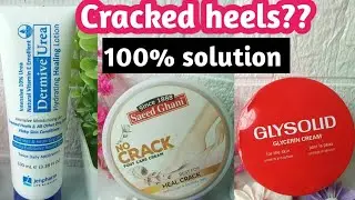 Best Cream for Cracked Heels in Pakistan | 100% Effective Solutions & Honest Review
