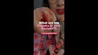 What are the chunks in my period?
