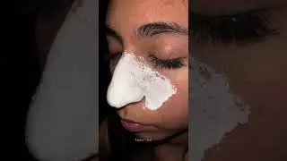 Nose Strips for Blackheads Removal,Deep Cleansing Pore Strips|Link in Bio😍 #viral #trending