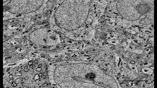 Multimedia 9. Columnar Spacelapse Video Displays Pervasive SCN Neuronal Soma-Soma Ephapses.