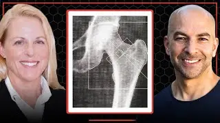 Bone loss in menopause: hormone replacement therapy & other strategies to mitigate negative effects