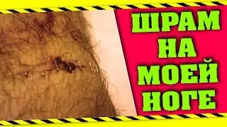 МГНОВЕННАЯ КАРМА - ЧУТЬ НЕ ОТРЕЗАЛО НОГУ (СЛУЧАЙ ИЗ ЖИЗНИ)
