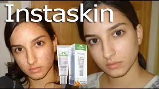 Instaskin (инстаскин) крем от прыщей