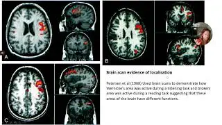 Evaluation of localisation of brain function