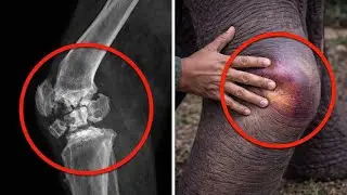 Injured Elephant Calf Fighting for Survival Gets Life-Saving Medicine in Dramatic Jungle Rescue