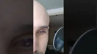 3d printed prosthetic eye with wireless led