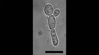 Candida Tropicalis 1