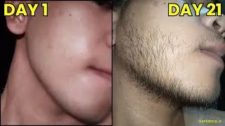 3 Week Beard Growth Using Minoxidil 🇵🇭 | Real Pinoy Result (Day 1 to 21 Transformation)
