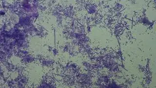 Gastroenterology. Lingua bacteria. Neisseria spp.