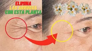Elimina Las Arrugas Con Flor De LIRIOS, Te Sorprendera Los Beneficios QueT Tiene!