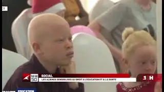 Sensibilisation et appui social aux enfants albinos de Tshangu et Lukunga