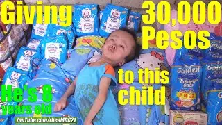 Giving 30,000 Pesos Worth of Help to this Poor FILIPINO CHILD with Hydrocephalus. The Philippines