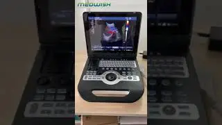 Full Digital Color Doppler Ultrasound Machine MYXF-3800
