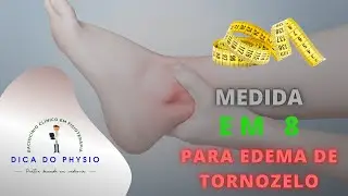 📝📌🔔[2021] Como avaliar o edema de TORNOZELO de seu PACIENTE