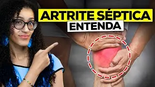 Artrite Séptica - Sintomas e Diagnóstico da Artrite Infecciosa