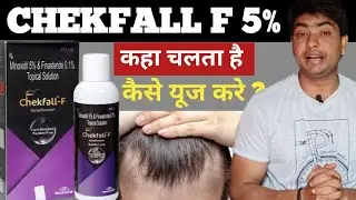 chekfall f solution/spray 60ml | chekfall f 5 lotion review | chekfall f how to use | chekfall f 5%