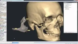 Freeform 2014 3 Point Alignment