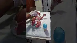 ۔It involves feeding the baby with formula milk or expressed breast milk using a feeding bottle.