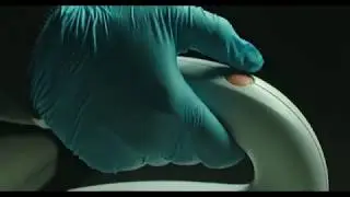 Innovative Ophthalmology IPL TV Commercial - Paducah KY