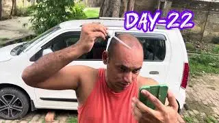 TDC advance hair regrowth system review || day-22 || #tdc #hairgrowth