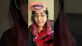 Best solution for lip pigmentation!! &ldquo;UAE BASED&rdquo;